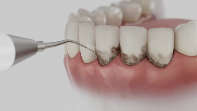 Trusted Dental Implants service in DeKalb, IL - Dentist Open Now